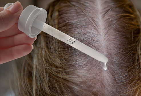 درمان ریزش مو با گیاهان دارویی