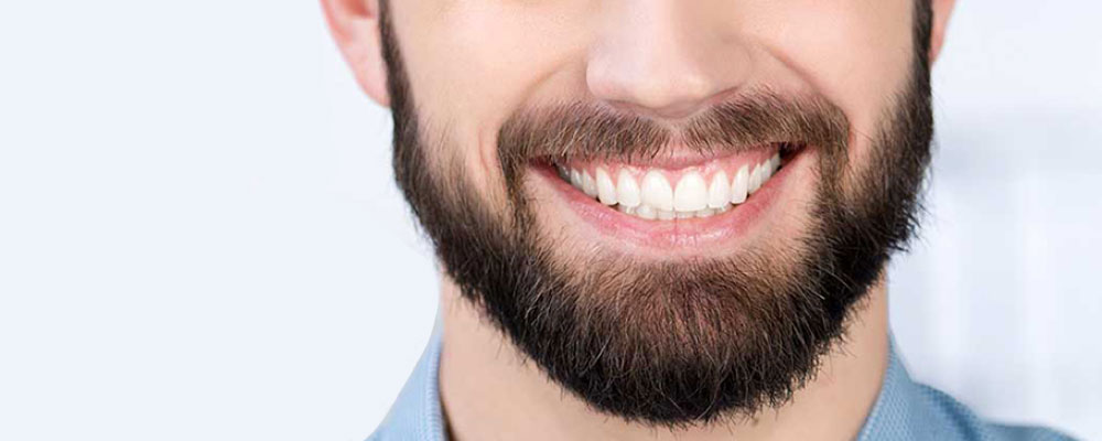 سن کاشت ریش و سبیل