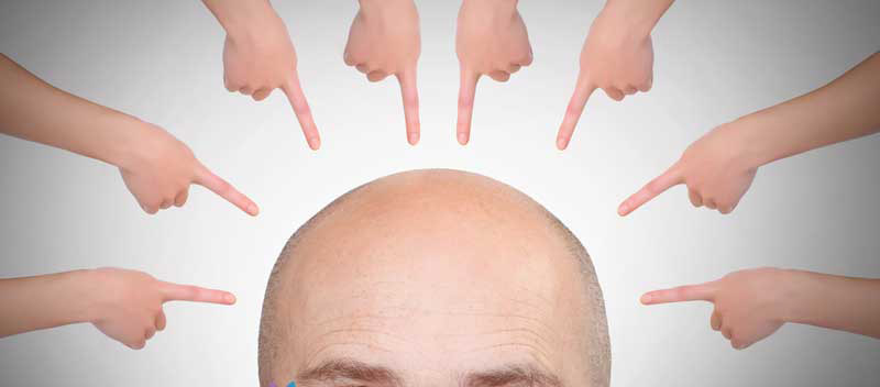 پکیج تقویت و جلوگیری از ریزش مو نیوشا
