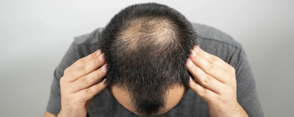 بانک مو چیست؟
