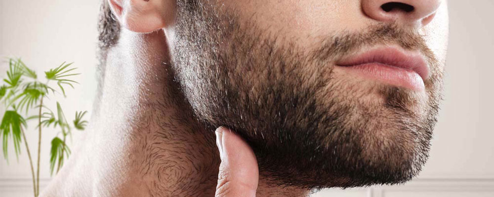 چه کسانی می توانند کاندید کاشت ریش شوند