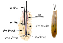 تکنیک های بازسازی مو