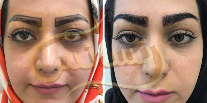 كاشت ابرو و مژه