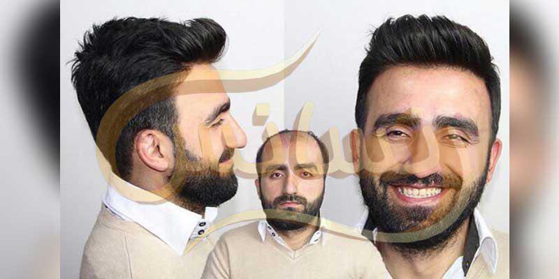 ترمیم مو