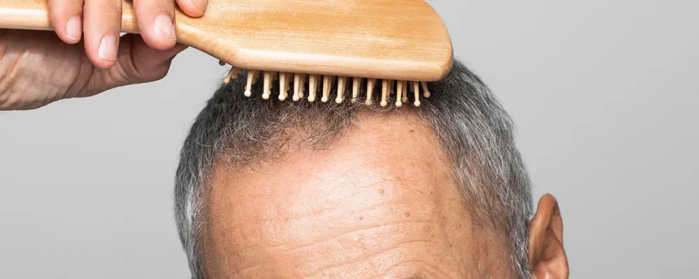 آیا کاشت مو BHT انتخاب مناسبی است؟