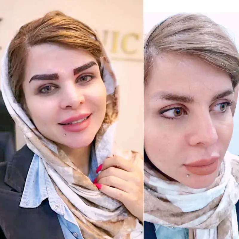 گالری تصاویر