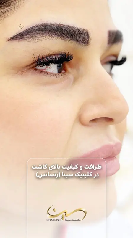 گالری تصاویر