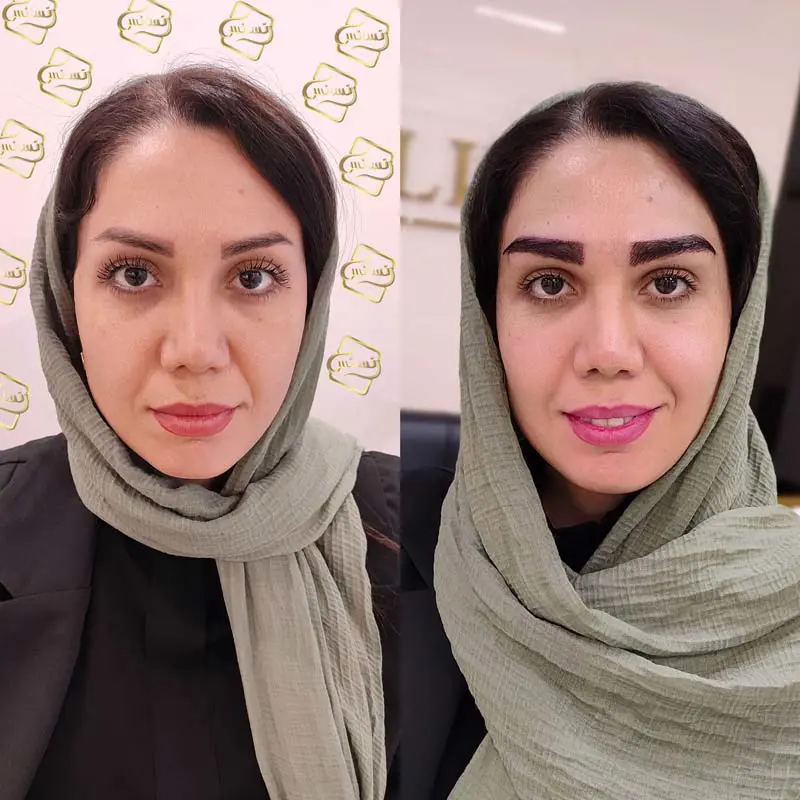 گالری تصاویر
